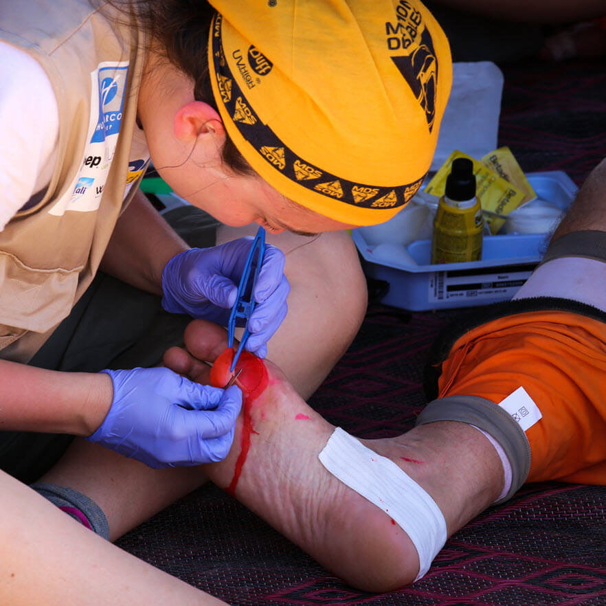 How To Best Provide Athletic Event Foot Care